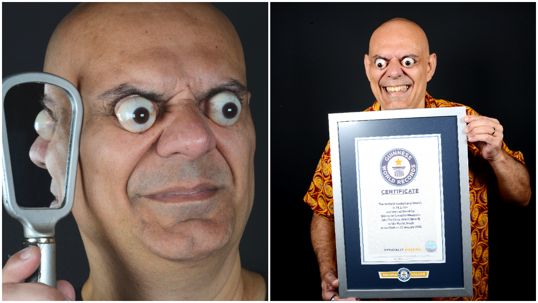 split image of Sidney showing his eyeball pop in front of mirror and with certificate